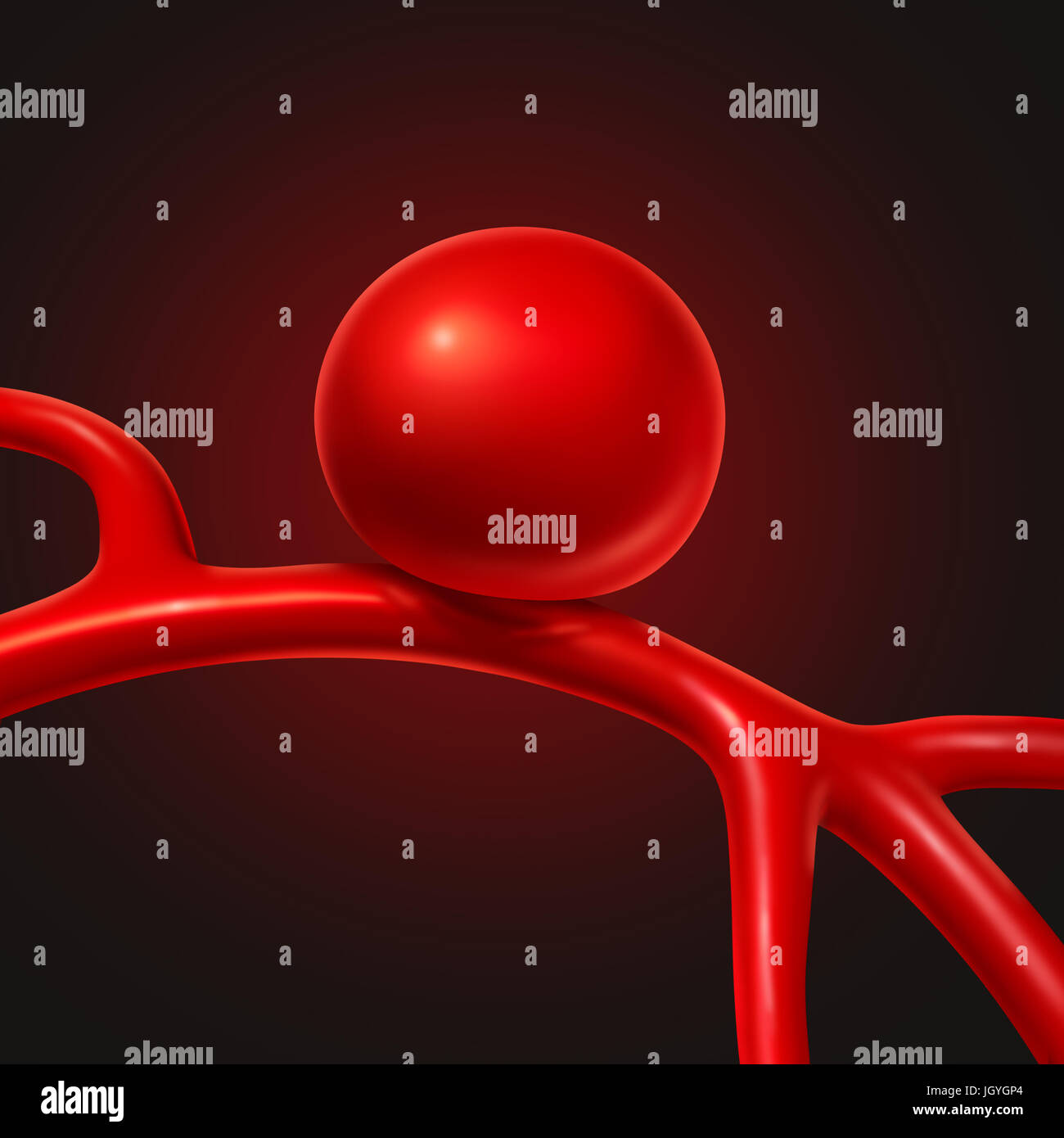 Aneurysma medizinisches Konzept als Medizin Symbol für Symptome und Diagnose eines Blutgefäßes, die in die Form eines Ballons prall gefüllt ist. Stockfoto
