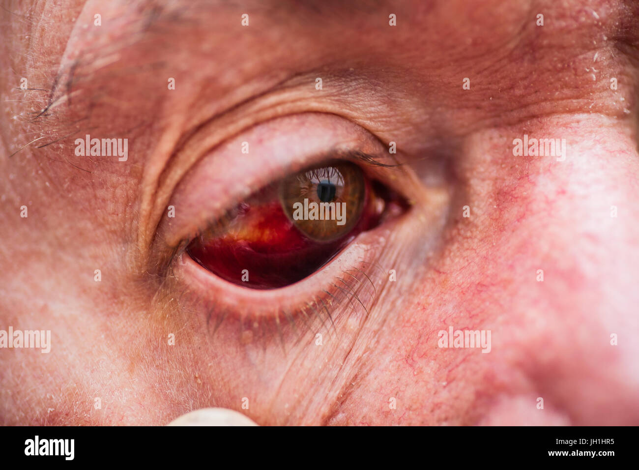 Ältere männliche mit blutunterlaufenen Augen Stockfoto