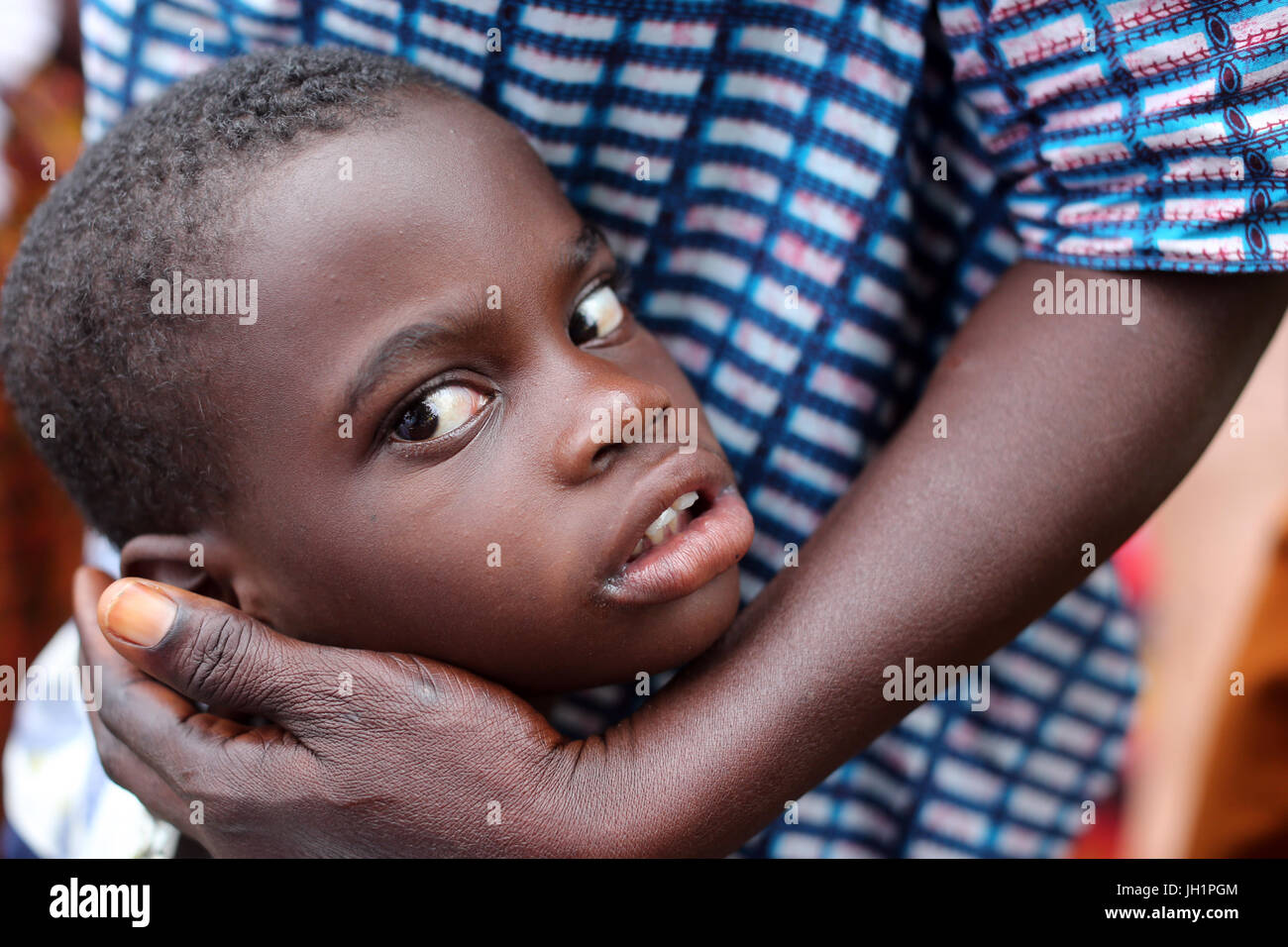 Krankes afrikanische Kind und Vater.  Togo. Stockfoto