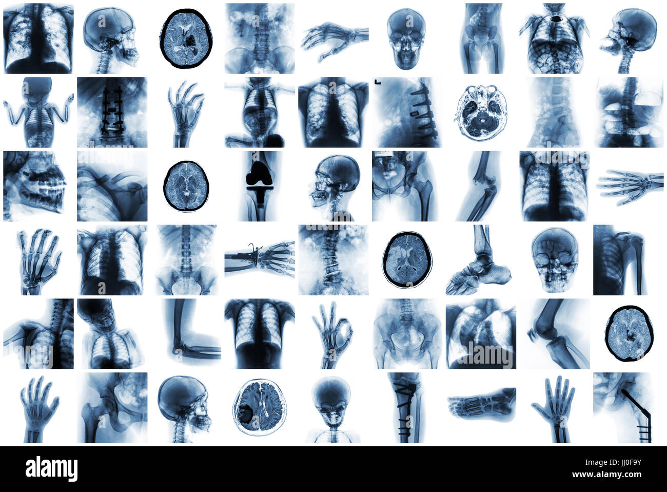 X-ray mehrere Teile der menschlichen und viele Beschwerden und Krankheit. Stockfoto