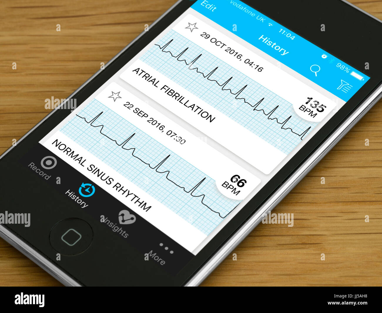 Mobile Gesundheit und Fitness app Herz EKG-Kurven für Vorhofflimmern Arrhythmie- und normalen Sinusrhythmus auf einem Apple Gerät. Stockfoto