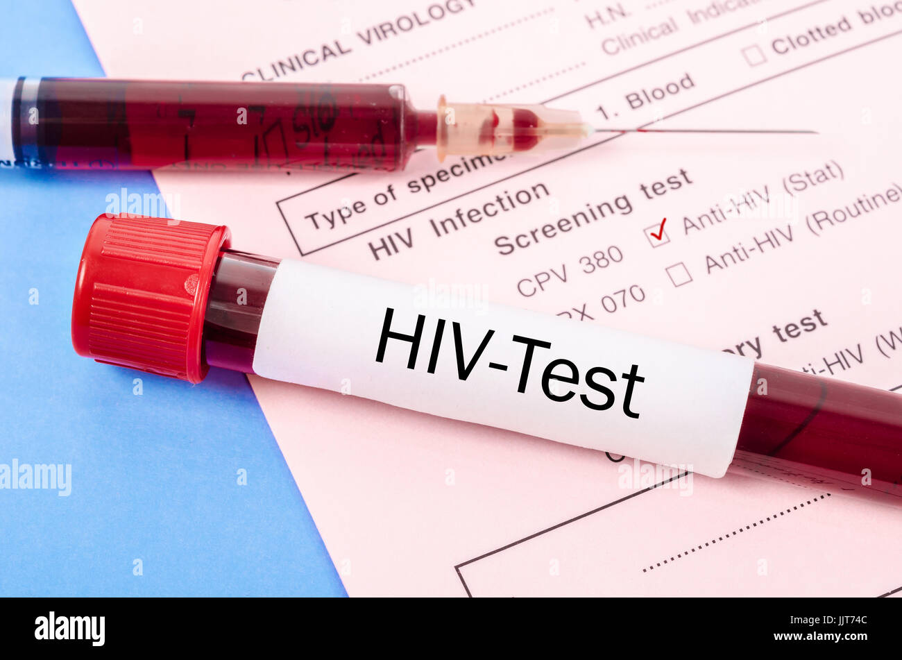 Blut Sammlung Probenröhrchen mit HIV Test Label auf HIV-Infektion screening Testform. Stockfoto