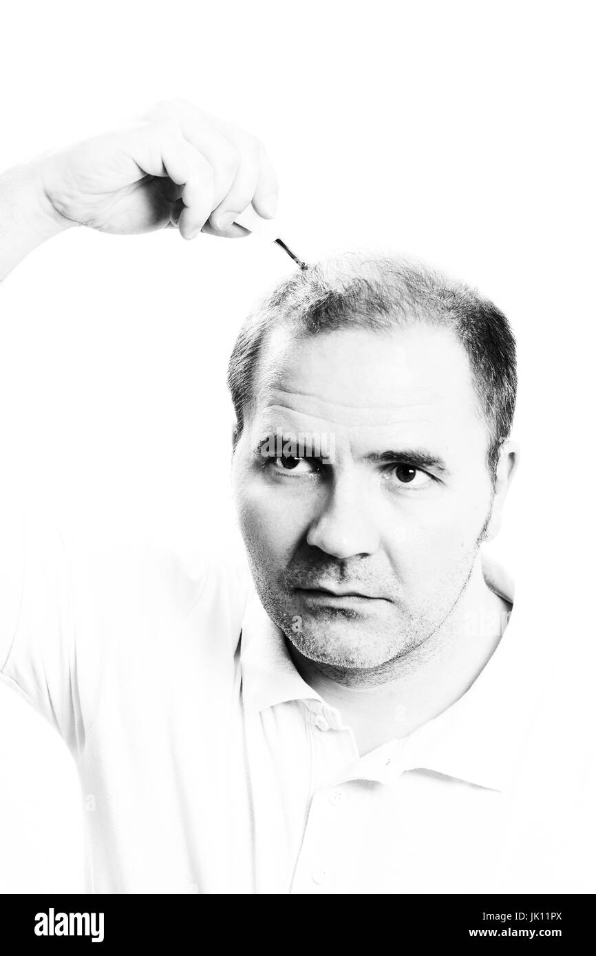 Mann mittleren Alters betroffen Haar Verlust Glatze Haarausfall Alopezie schwarz / weiß Stockfoto