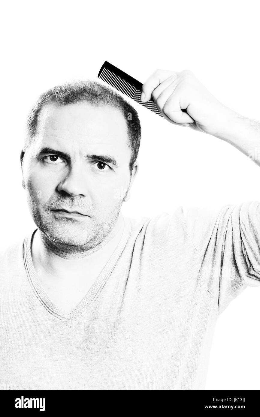 Mann mittleren Alters betroffen Haar Verlust Glatze Haarausfall Alopezie isoliert Stockfoto