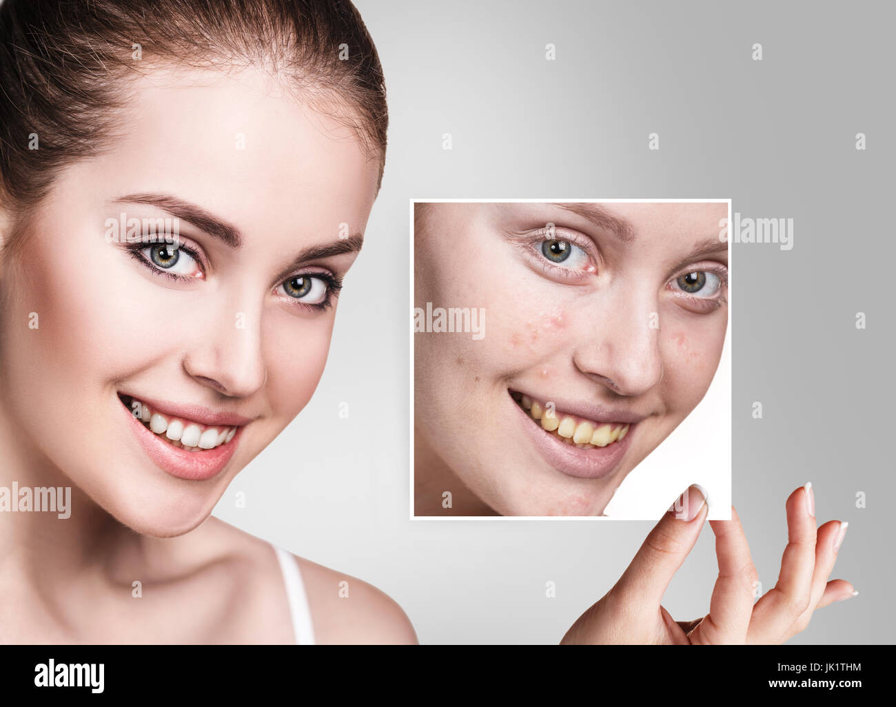 Frau zeigt Fotos mit unreiner Haut vor der Behandlung. Stockfoto