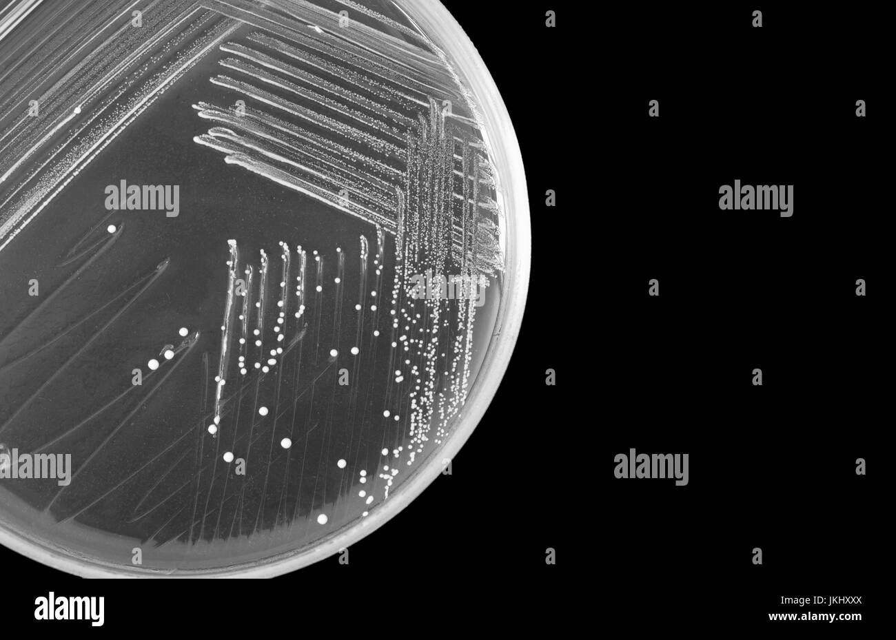 Makro von Bakterien auf Petrischale isoliert auf schwarzem Hintergrund, Konzept-Wissenschaft-Forschung oder Wissenschaft Educaton Textfreiraum Stockfoto