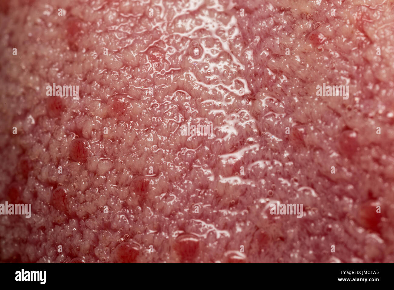 Makro Foto von Geschmacksknospen auf der Zunge Stockfoto