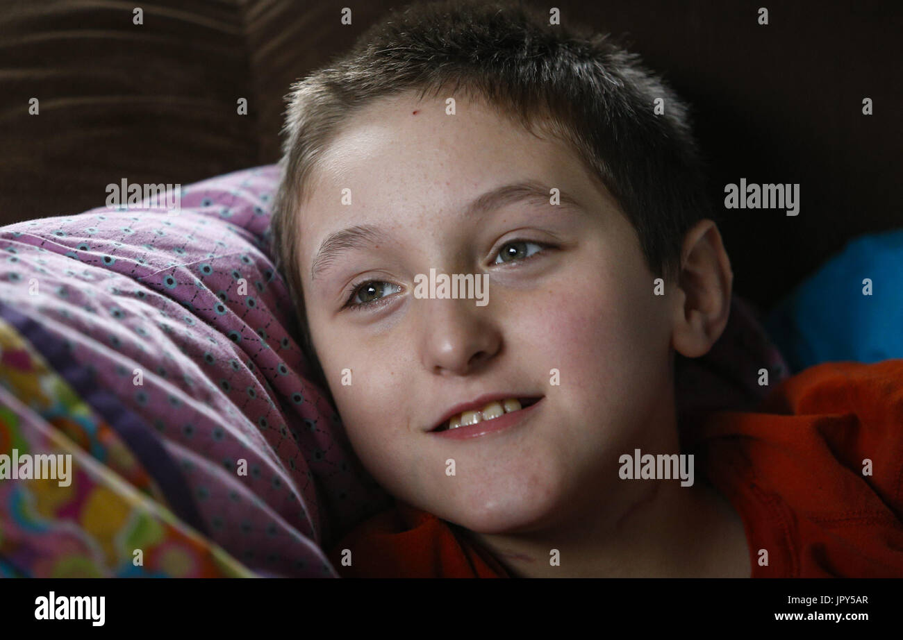 Davenport, Iowa, USA. 12. Januar 2017. Ryan McDermott, 10, lächelt und schaut aus dem Fenster auf die McDermott zu Hause in Davenport auf Donnerstag, 12. Januar 2017. McDermott war als Kleinkind mit Dravet-Syndrom, einer schweren Form von Epilepsie diagnostiziert und hat derzeit zwischen 10 und 20 Anfälle pro Tag. Eine Cannabis-Öl-Studie durch die Universität von Iowa funktionierte nicht für McDermott, aber er wird in Kürze eine Studie durch die Mayo-Klinik namens Fenfluramin Bewertung bei seltenen Epilepsie beginnen. Bildnachweis: Andy Abeyta/Quad-Stadt-Zeiten / ZUMA Draht/Alamy Live News Stockfoto
