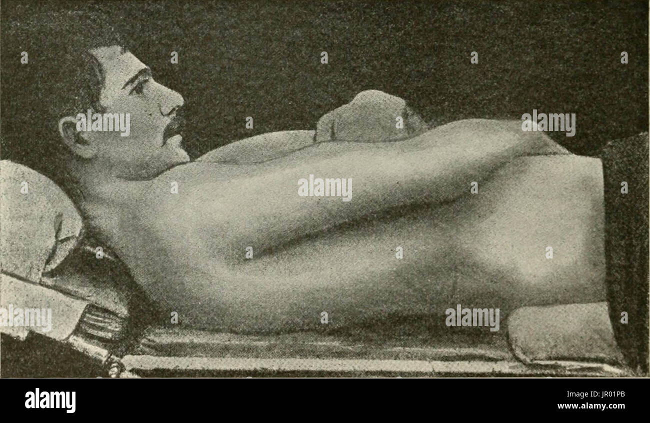 "Lokale und regionale Anästhesie; mit Kapiteln über spinale, epidurale, paravertebralen und Parasacral Analgesie und andere Anwendungen der lokalen und regionalen Anästhesie die Operation der Augen, Ohren, Nase und Rachen und Zahnarztpraxis " Stockfoto