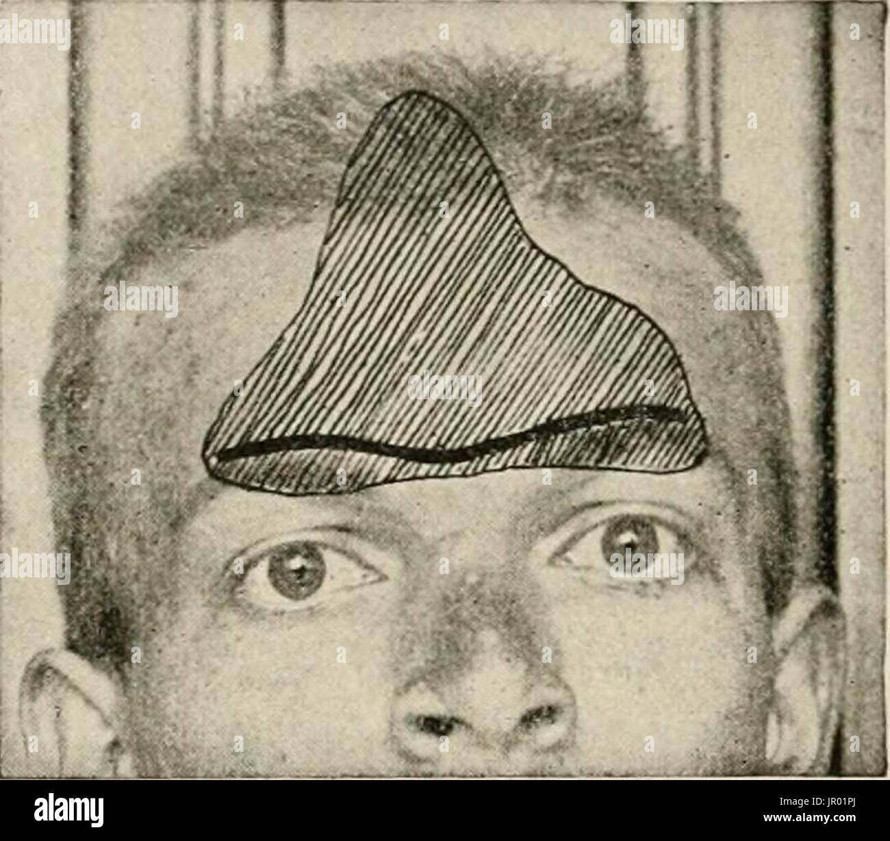 "Lokale und regionale Anästhesie; mit Kapiteln über spinale, epidurale, paravertebralen und Parasacral Analgesie und andere Anwendungen der lokalen und regionalen Anästhesie die Operation der Augen, Ohren, Nase und Rachen und Zahnarztpraxis " Stockfoto