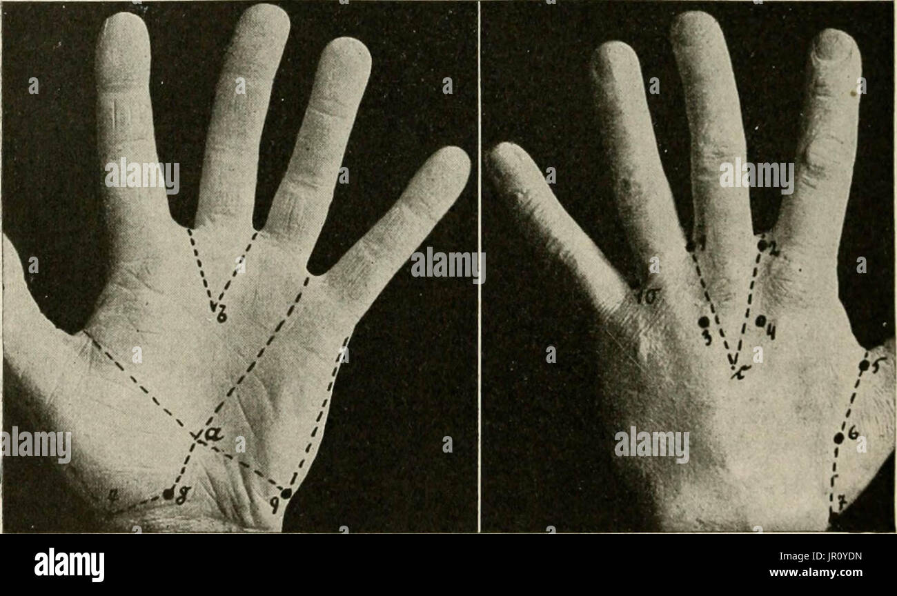 "Lokale und regionale Anästhesie; mit Kapiteln über spinale, epidurale, paravertebralen und Parasacral Analgesie und andere Anwendungen der lokalen und regionalen Anästhesie die Operation der Augen, Ohren, Nase und Rachen und Zahnarztpraxis " Stockfoto