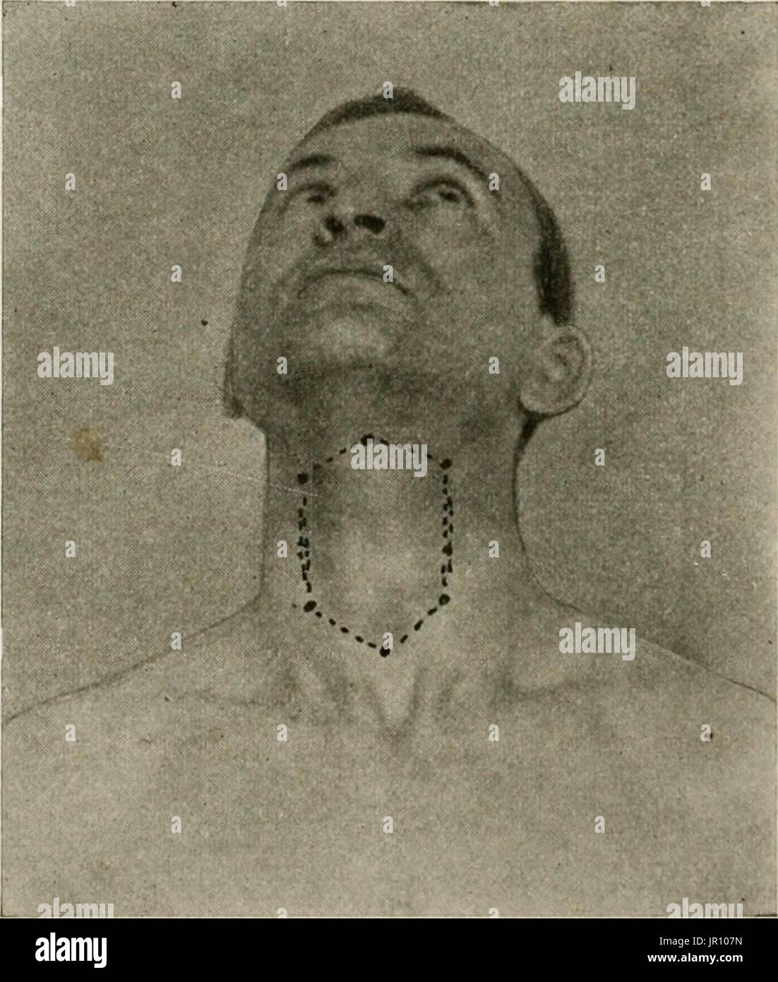 "Lokale und regionale Anästhesie; mit Kapiteln über spinale, epidurale, paravertebralen und Parasacral Analgesie und andere Anwendungen der lokalen und regionalen Anästhesie die Operation der Augen, Ohren, Nase und Rachen und Zahnarztpraxis " Stockfoto