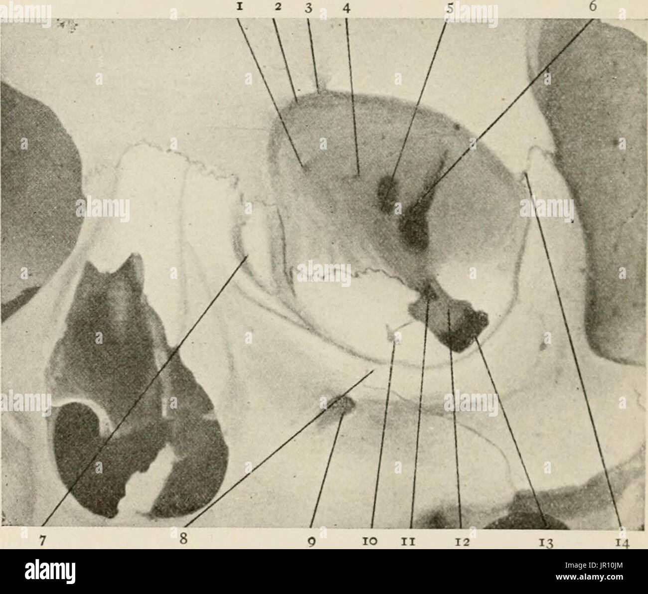 "Lokale und regionale Anästhesie; mit Kapiteln über spinale, epidurale, paravertebralen und Parasacral Analgesie und andere Anwendungen der lokalen und regionalen Anästhesie die Operation der Augen, Ohren, Nase und Rachen und Zahnarztpraxis " Stockfoto