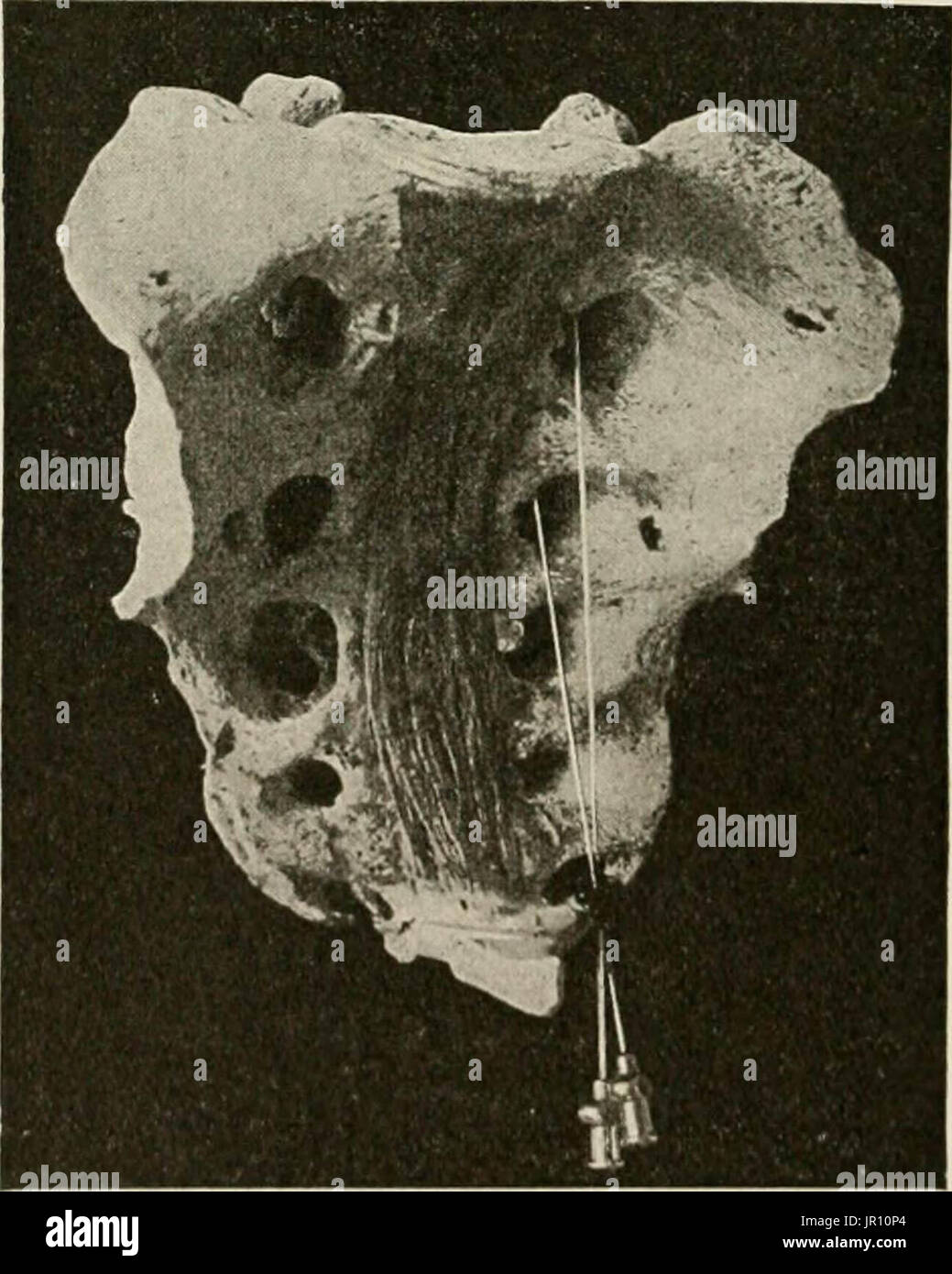 "Lokale und regionale Anästhesie; mit Kapiteln über spinale, epidurale, paravertebralen und Parasacral Analgesie und andere Anwendungen der lokalen und regionalen Anästhesie die Operation der Augen, Ohren, Nase und Rachen und Zahnarztpraxis " Stockfoto