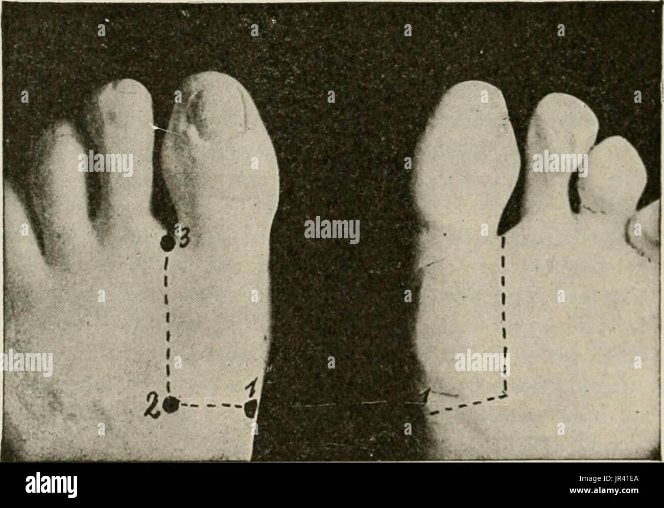 "Lokale und regionale Anästhesie; mit Kapiteln über spinale, epidurale, paravertebralen und Parasacral Analgesie und andere Anwendungen der lokalen und regionalen Anästhesie die Operation der Augen, Ohren, Nase und Rachen und Zahnarztpraxis " Stockfoto