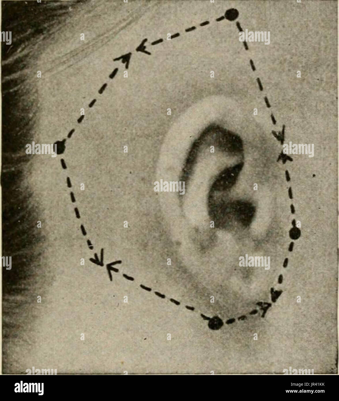"Lokale und regionale Anästhesie; mit Kapiteln über spinale, epidurale, paravertebralen und Parasacral Analgesie und andere Anwendungen der lokalen und regionalen Anästhesie die Operation der Augen, Ohren, Nase und Rachen und Zahnarztpraxis " Stockfoto