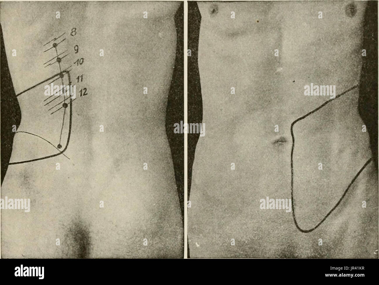 "Lokale und regionale Anästhesie; mit Kapiteln über spinale, epidurale, paravertebralen und Parasacral Analgesie und andere Anwendungen der lokalen und regionalen Anästhesie die Operation der Augen, Ohren, Nase und Rachen und Zahnarztpraxis " Stockfoto
