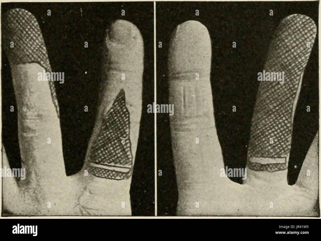 "Lokale und regionale Anästhesie; mit Kapiteln über spinale, epidurale, paravertebralen und Parasacral Analgesie und andere Anwendungen der lokalen und regionalen Anästhesie die Operation der Augen, Ohren, Nase und Rachen und Zahnarztpraxis " Stockfoto