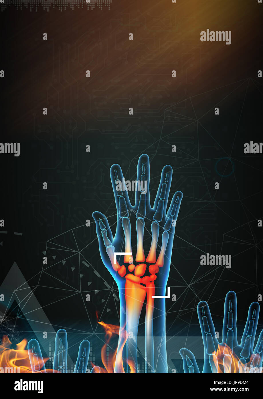 3D gerenderten Anatomie-Illustration - Hand-Schmerzen Stockfoto