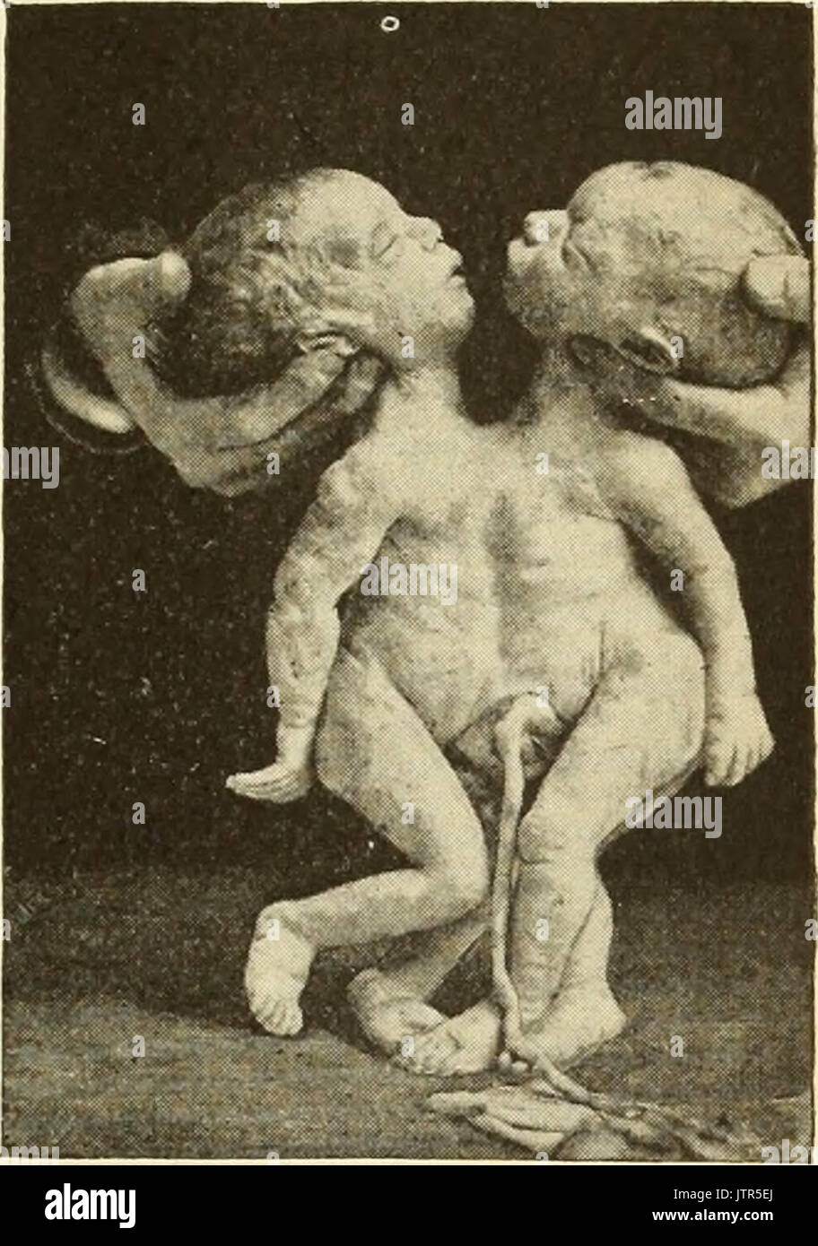 "Ein amerikanisches Lehrbuch der Geburtshilfe. Für Praktiker und Studenten" (1897) Stockfoto