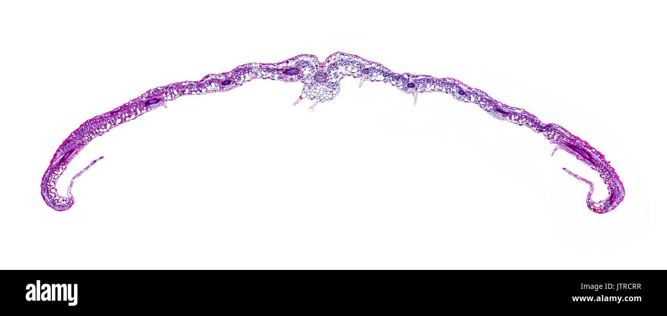 Pteridium aquilinum jungen und ausgereiften Wedel TS, Bracken fern, hellfeld photomicrograph Stockfoto