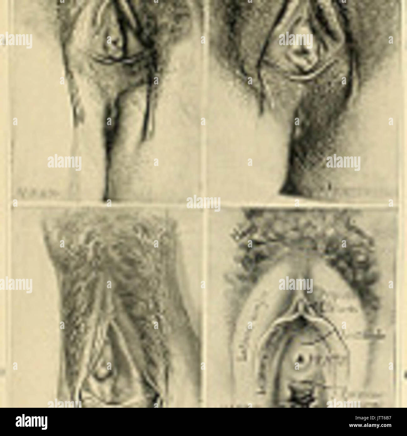 "Ein amerikanisches Lehrbuch der Geburtshilfe. Für Praktiker und Studenten" (1897) Stockfoto