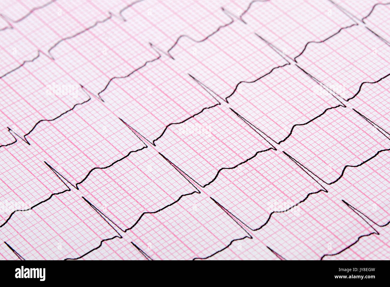 Nahaufnahme von einem Elektrokardiographen auch als einen EKG- oder EKG-Diagramm bekannt Stockfoto