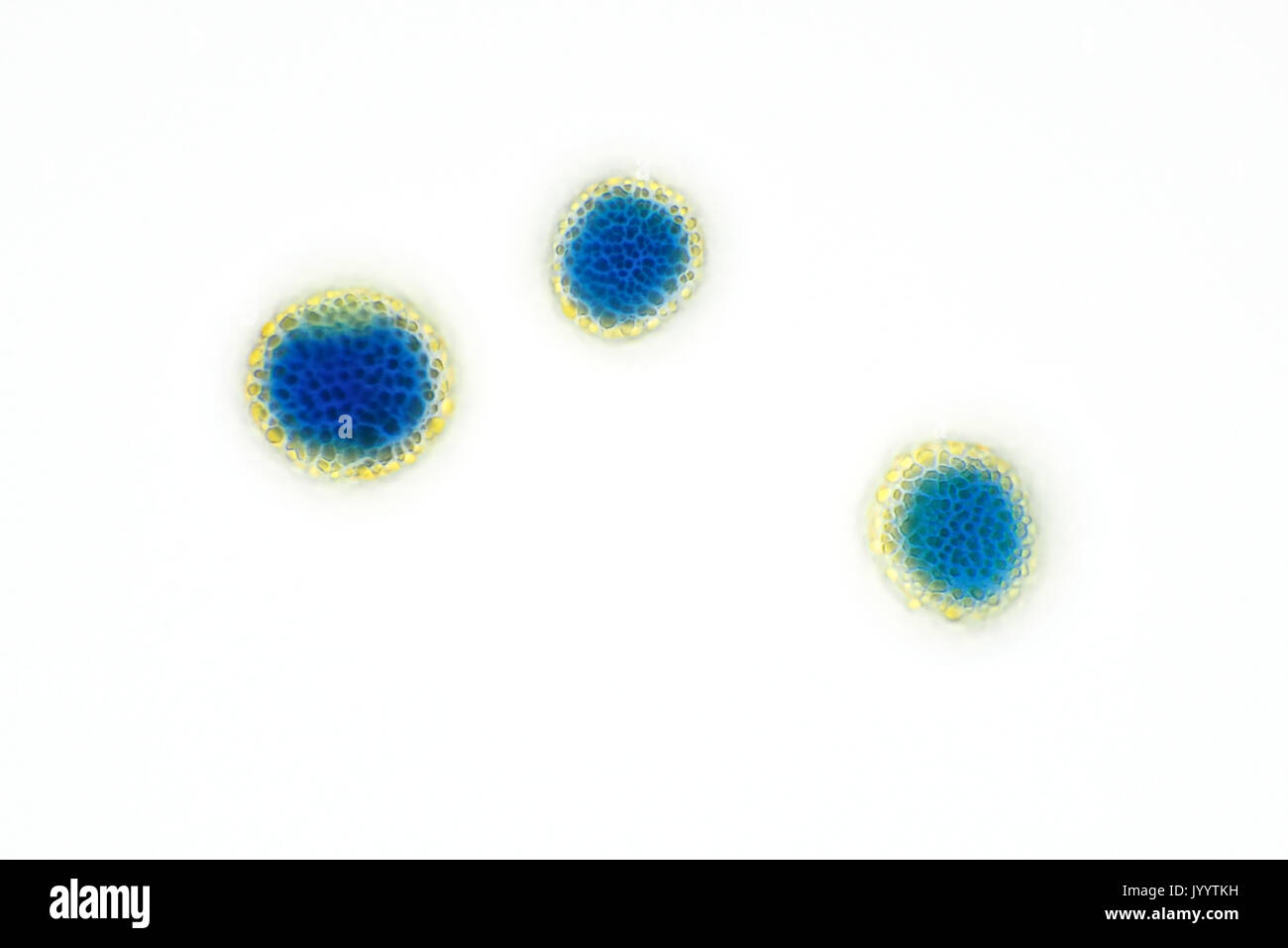 Pollenkörner (Sporen) von einem Air Probe, gefärbt mit blau Methyl, helle Arbeitsscheinwerfer Schliffbild, Größe der einzelnen Teilchen 17-22 Mikrometer Stockfoto