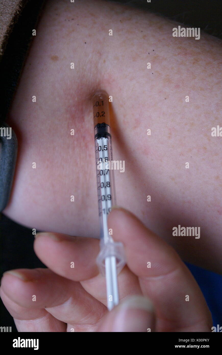Drogenabhängigkeit, Injektion von Heroin Stockfoto
