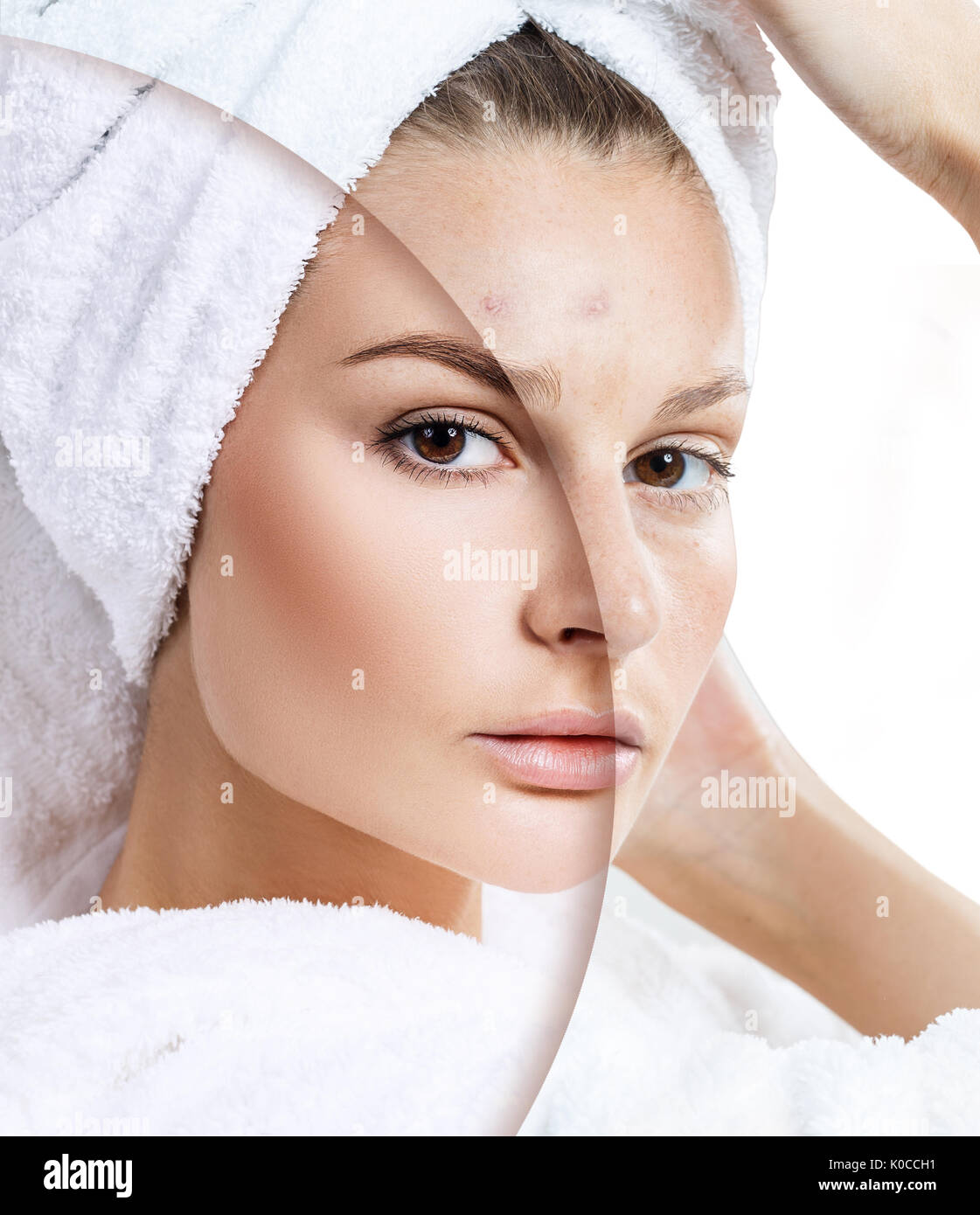 Junge Frau vor und nach der Behandlung. Stockfoto