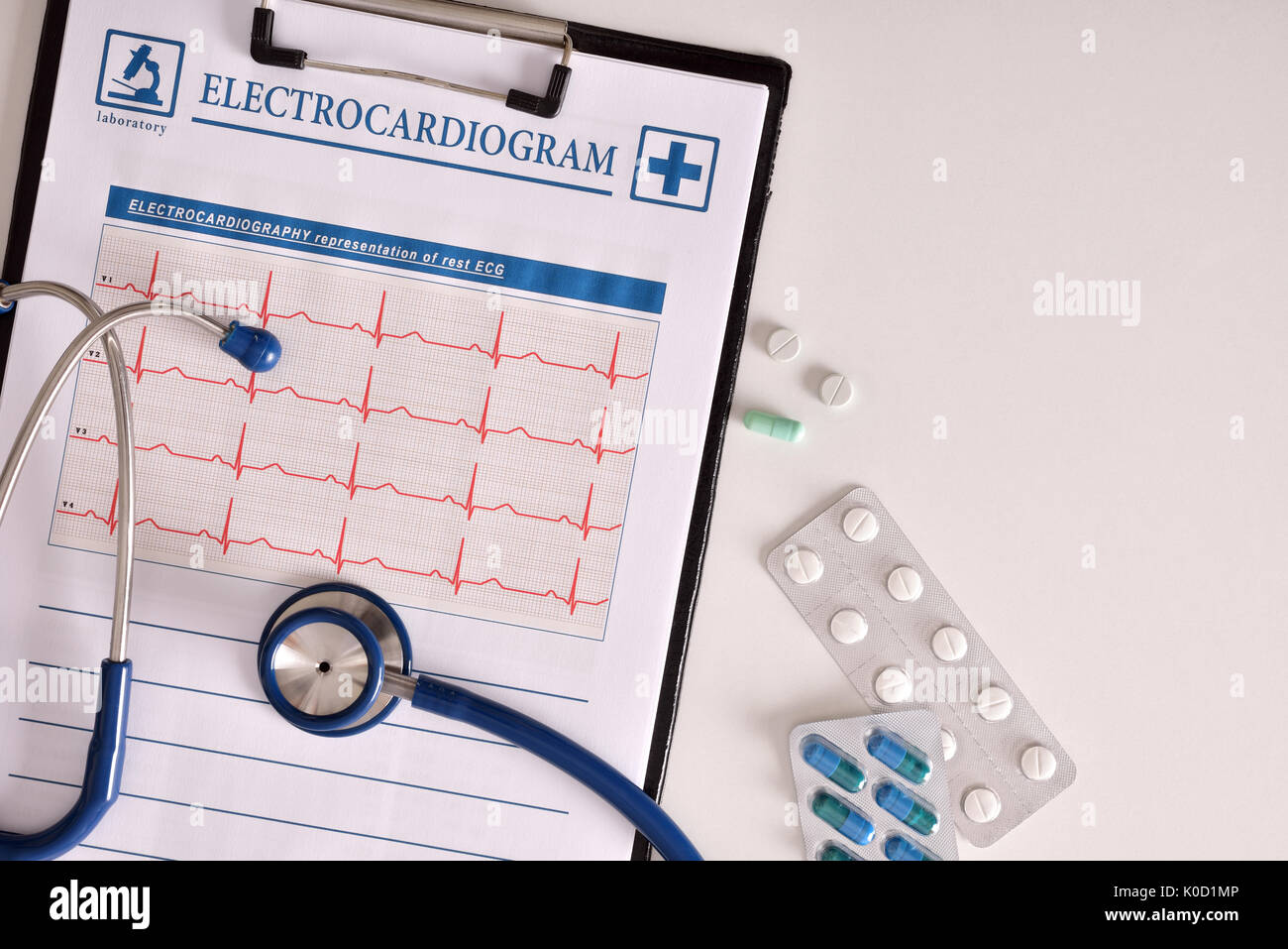 Ergebnisse der Untersuchung des Herzens mit Zwischenablage Elektrokardiogramm präsentieren. Ostetoscope und Behandlung Pillen auf weißer Tisch. Ansicht von oben. Horizontale Stockfoto
