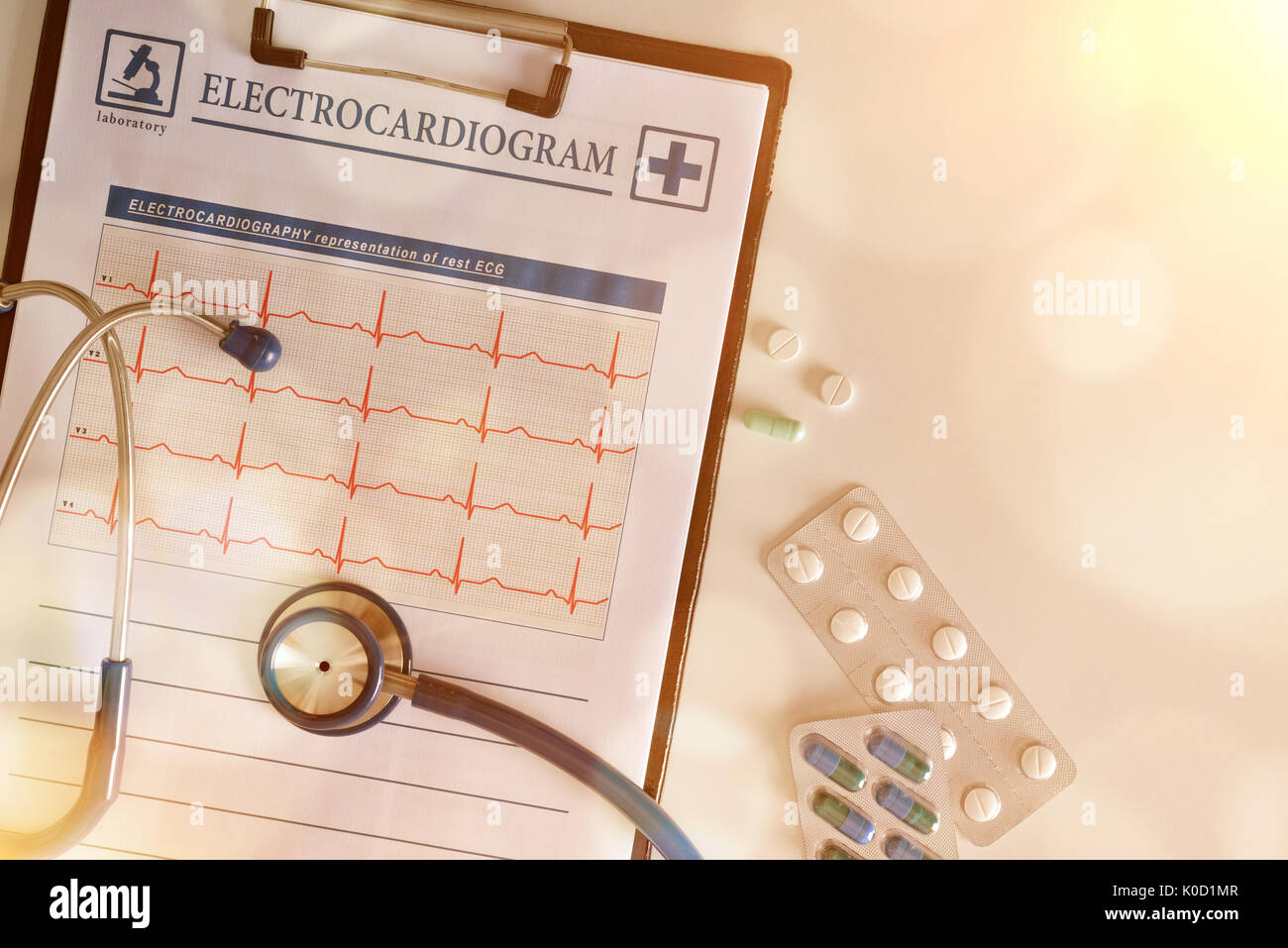 Ergebnisse der Untersuchung des Herzens mit Zwischenablage Elektrokardiogramm präsentieren. Ostetoscope und Behandlung Pillen auf weißer Tisch. Ansicht von oben. Horizontale Stockfoto