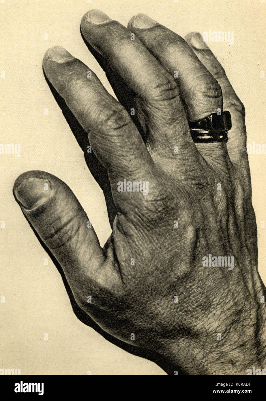 Igor Strawinskys Hand, 1929. Er direkt auf dem Klavier. Russischer Komponist, 1882-1971. Stockfoto