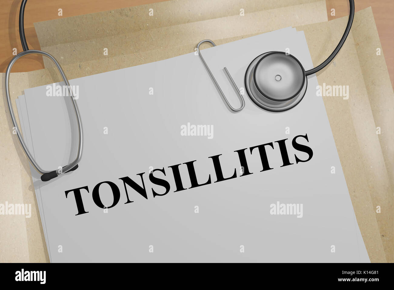 Swollen tonsil Fotos und Bildmaterial in hoher Auflösung Alamy