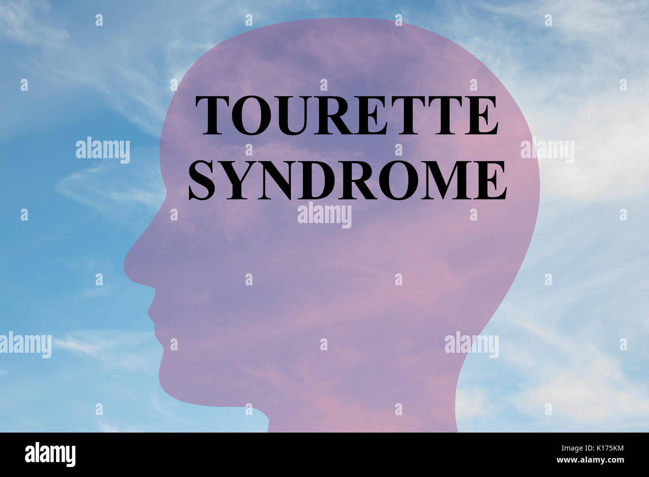 Render Abbildung: "Tourette Syndrom' Skript auf dem Kopf silhouette, mit bewölktem Himmel als Hintergrund. Stockfoto