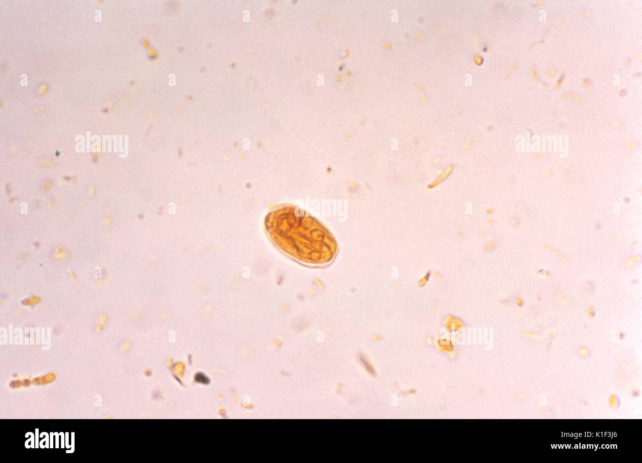 Photomicrograph einer Giardia-lamblia-Zyste visualisiert mit einem Jod Fleck. Giardia-lamblia-, den Parasiten verursacht, Giardiasis, lebt in zwei Stufen: trophozoiten und Zysten. Trophozoiten sind eine aktive Form des Parasiten im Körper. Zysten stellen eine Ruhephase, die der Parasit außerhalb des Körpers überleben ermöglicht. Bild mit freundlicher Genehmigung von CDC/Dr. Mae Melvin, 1977. Stockfoto
