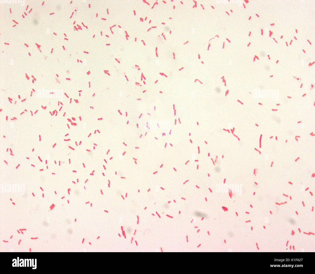 Yersinia pestis, Gram-negativen Bazillus. Y.-pestis-, ist ein kleiner (0,5 x 1,0{Mikro} M) Gram-negativen Bazillus. Bipolare Verfärbungen bei der Verwendung von Wayson, Wright, Giemsa, oder Methylenblau Fleck, und gelegentlich in Gramm gesehen werden - gefärbt Zubereitungen. Mit freundlicher CDC/mit freundlicher Genehmigung von Larry Stauffer, Oregon State Public Health Laboratory, 2002. Stockfoto