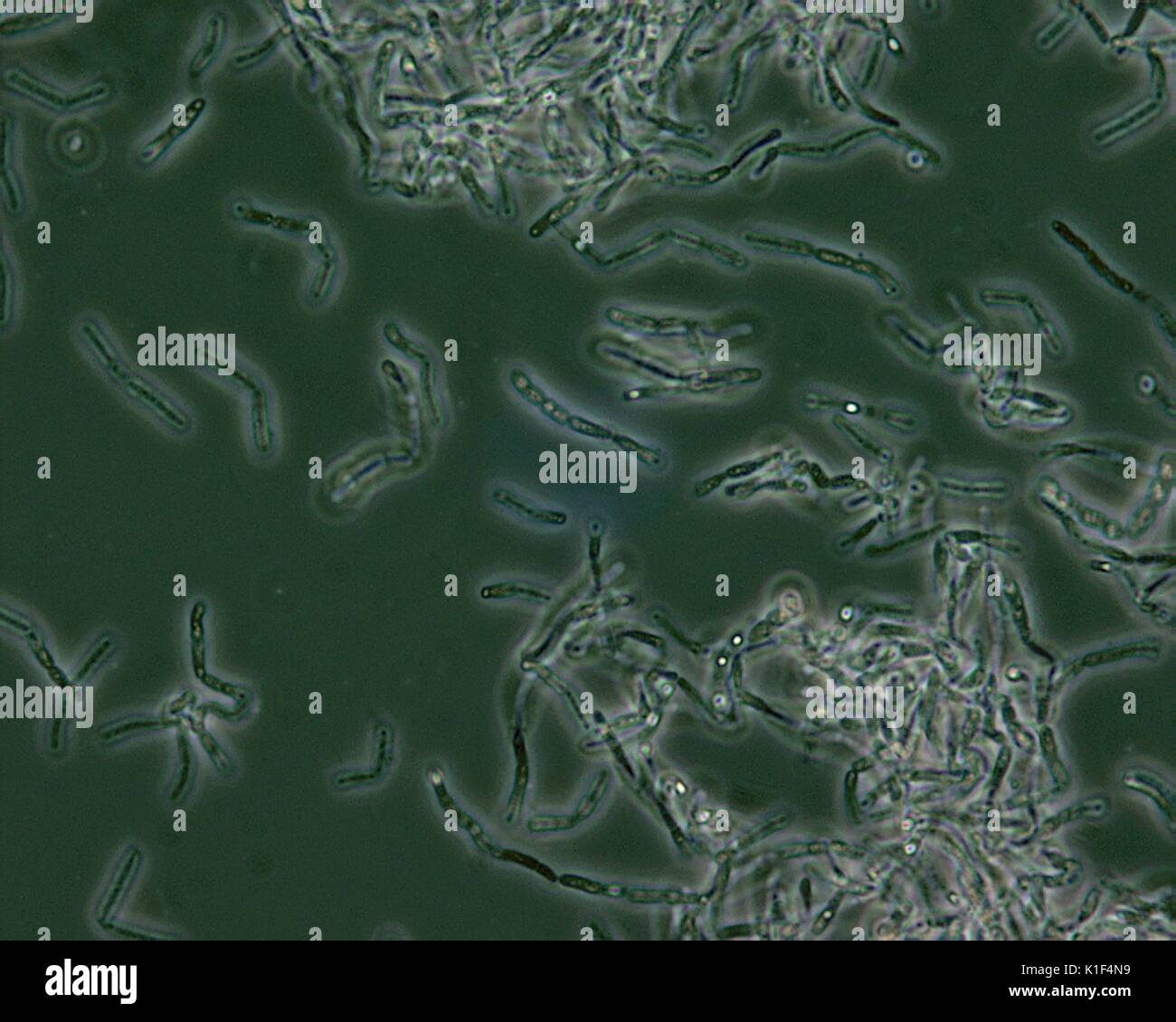 Bacillus anthracis Sporen unter Phasenkontrastmikroskopie gesehen. Bacillus anthracis endosporen sind unter Phasenkontrastmikroskopie als hellere Bereiche, Punkte, d. h. 'Licht', aufgrund der Tatsache, dass sie entwässert werden, und daher, mehr refractile gesehen. Mit freundlicher CDC/mit freundlicher Genehmigung von Larry Stauffer, Oregon State Public Health Laboratory, 2002. Stockfoto