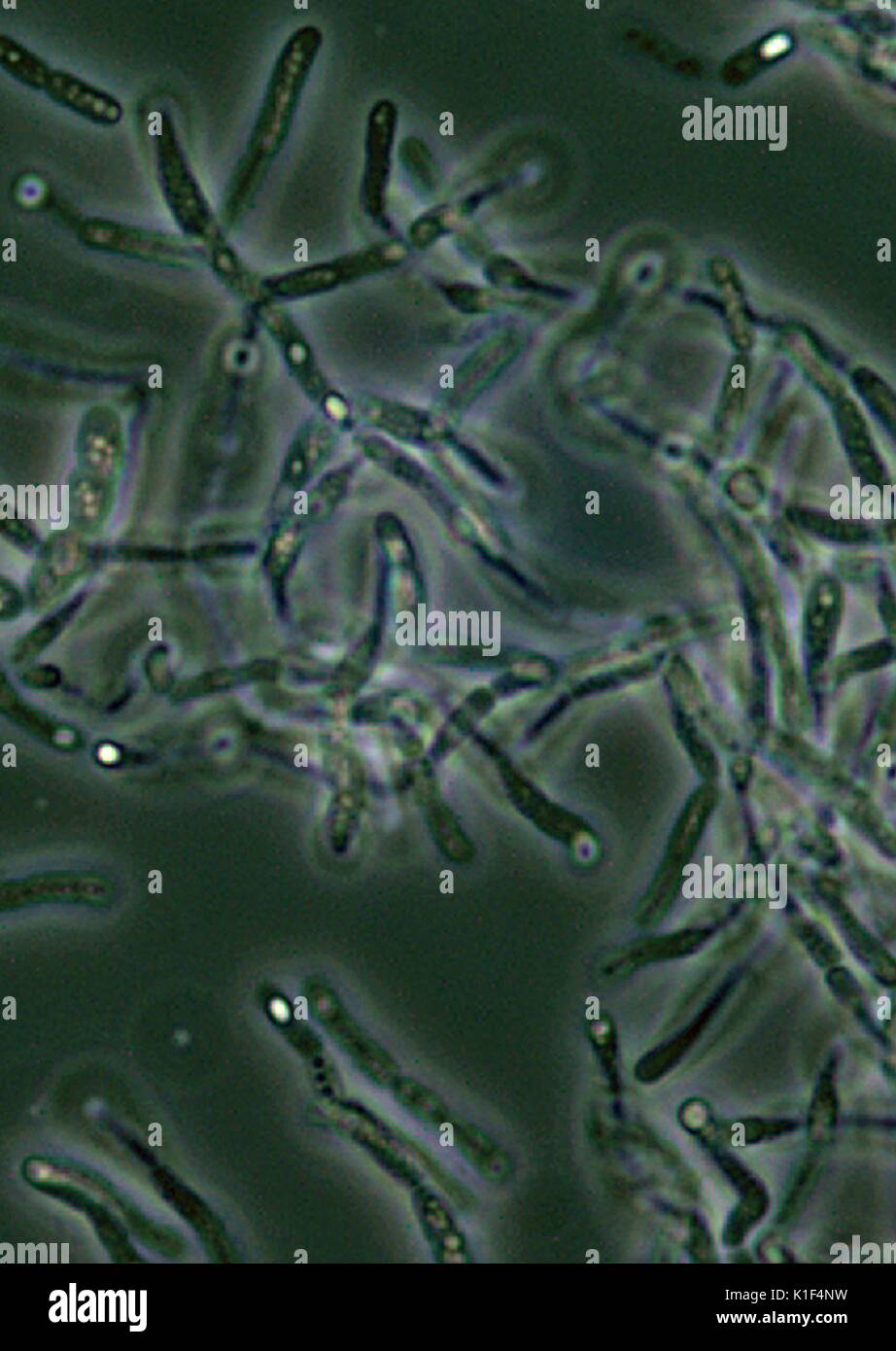 Bacillus anthracis Sporen unter Phasenkontrastmikroskopie gesehen. Bacillus anthracis endosporen sind unter Phasenkontrastmikroskopie als hellere Bereiche, Punkte, d. h. 'Licht', aufgrund der Tatsache, dass sie entwässert werden, und daher, mehr refractile gesehen. Mit freundlicher CDC/mit freundlicher Genehmigung von Larry Stauffer, Oregon State Public Health Laboratory, 2002. Stockfoto