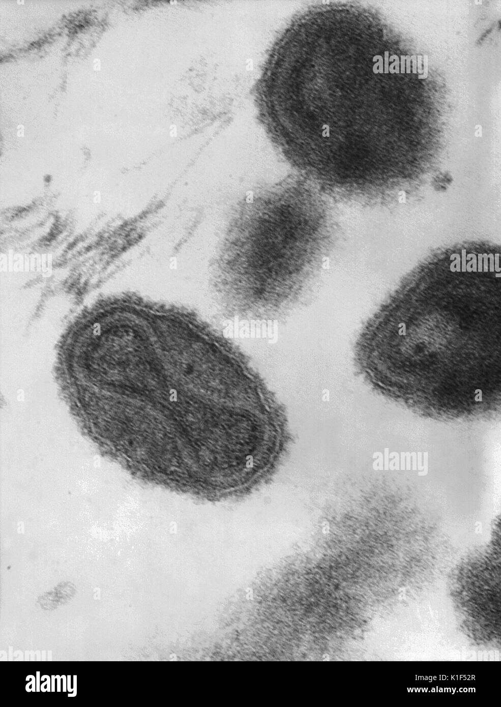 Diese Transmission Electron Micrograph (TEM) zeigt eine Reihe von pockenvirus Virionen, Mag - ungefähr 370 000 x. Die hantel-Form? Innere Struktur die Pocken virion ist die virale Kern, der die virale DNA enthält. Diese DNA fungiert als Blaupause, mit denen das Virus selbst repliziert, sobald es in die Wirtszelle freigesetzt wird. Bild mit freundlicher Genehmigung von CDC/Dr. Fred Murphy, Sylvia Whitfield, 1975. Stockfoto