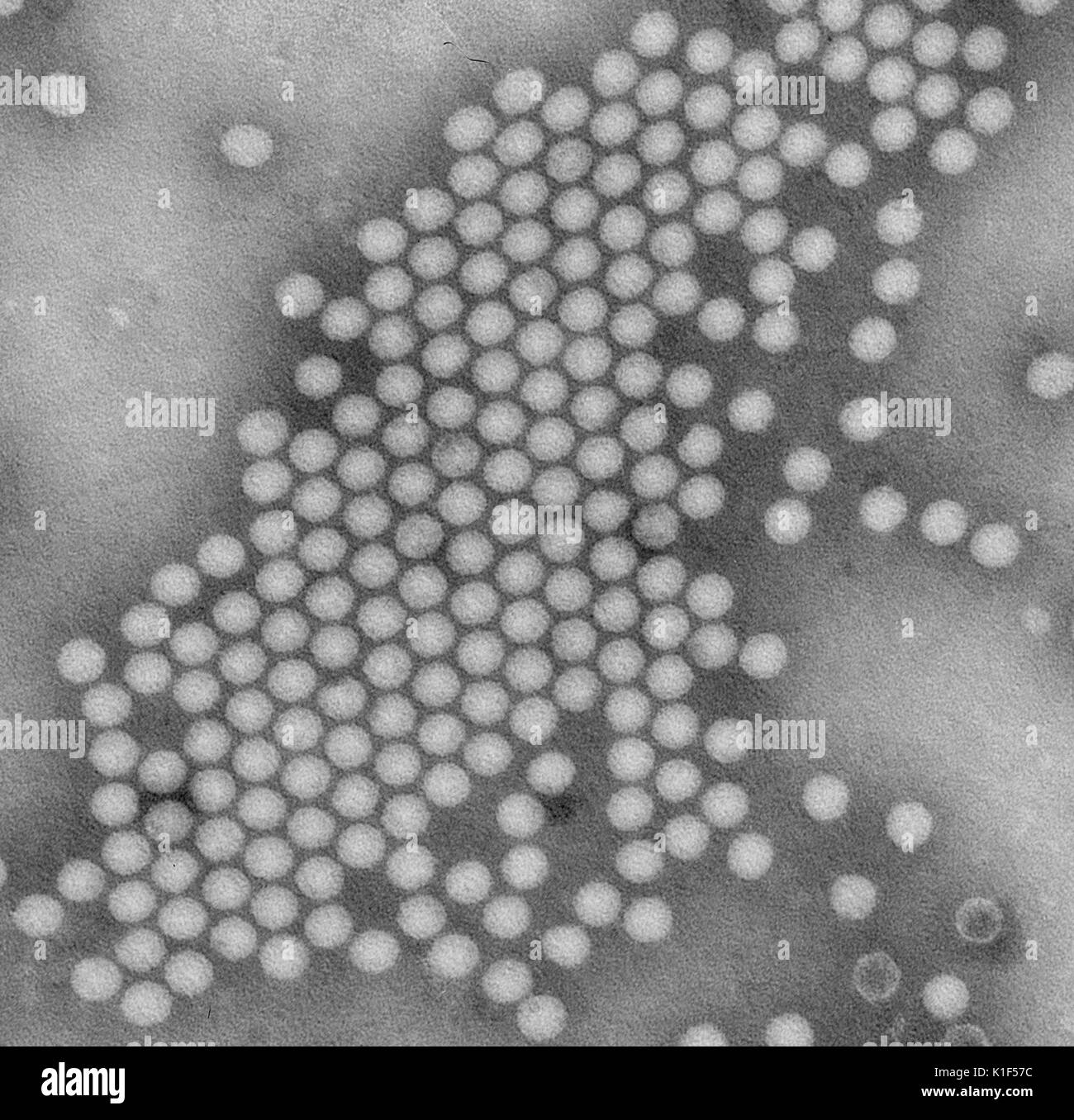 Transmission Electron Micrograph, negative Fleck Bild der Polio Virus. Mit freundlicher CDC/J. J. Esposito, F.A. Murphy, 1971. Stockfoto