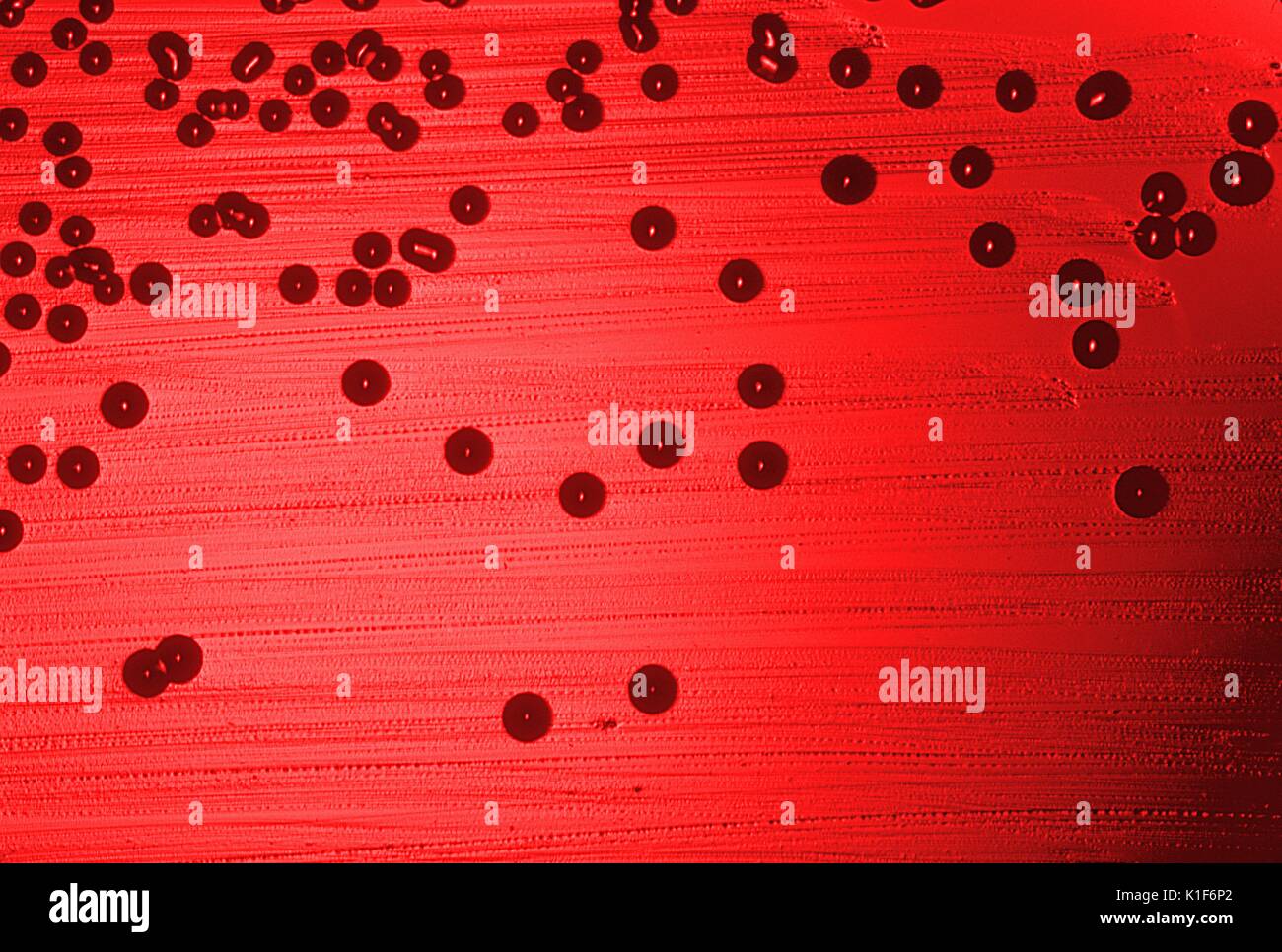 Blut Agarplatte Kultur Haemophilus influenzae. Bild mit freundlicher Genehmigung von CDC/Dr. W.A. Clark, 1977. Stockfoto