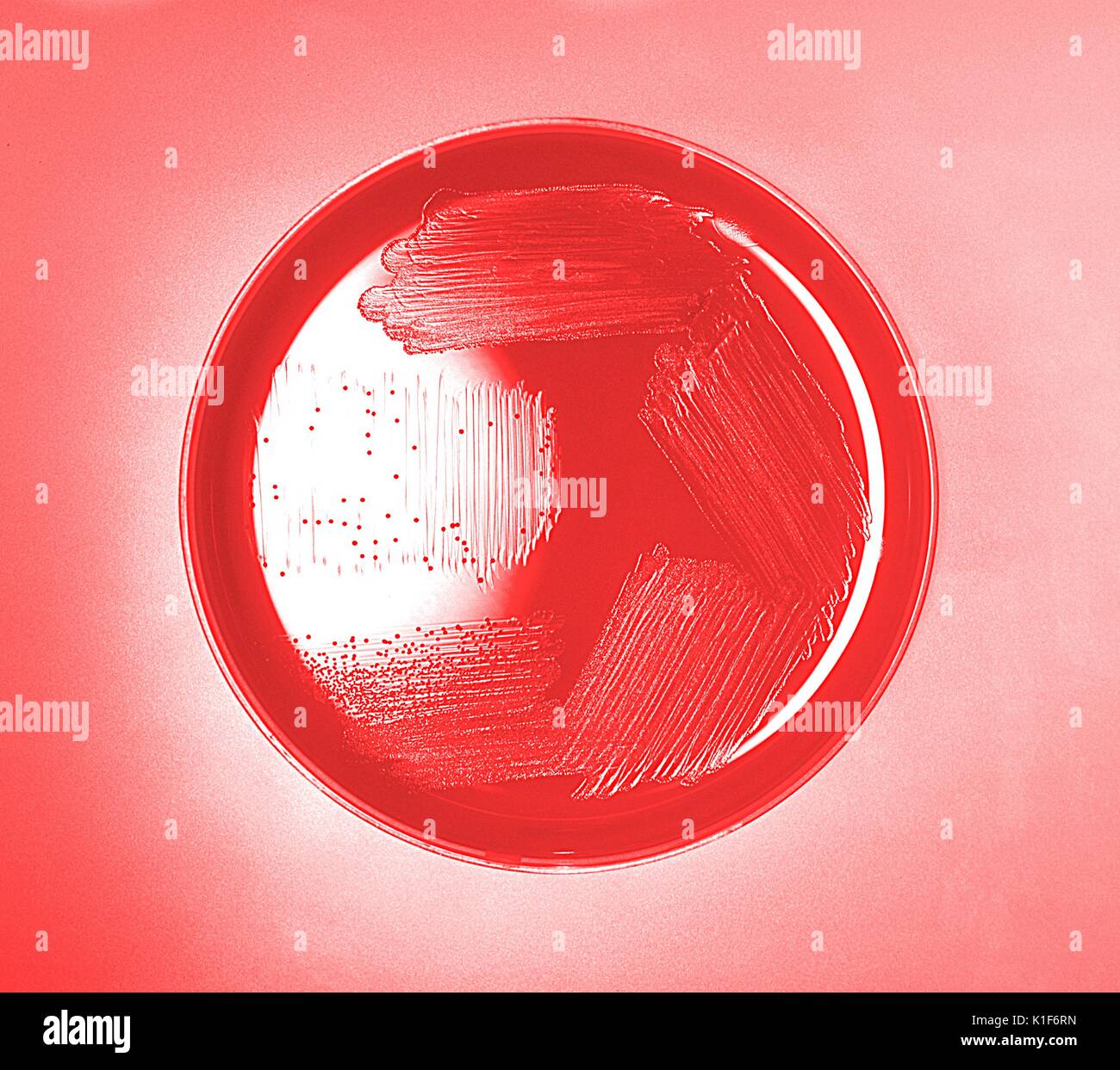 Blut Agarplatte Kultur Haemophilus influenzae. Bild mit freundlicher Genehmigung von CDC/Dr. W.A. Clark, 1977. Stockfoto