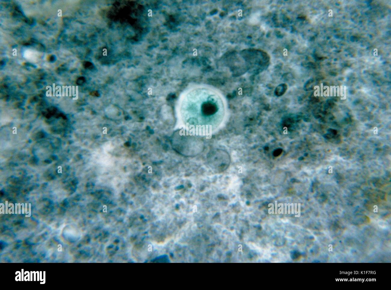 Das schliffbild gebeizt mit chlorazol Schwarz, Entamoeba histolytica, deckte eine Zyste. Einige Protozoen Gattung Entamoeba Menschen infizieren, aber nicht alle von ihnen sind mit Krankheit verbunden. Entamoeba histolytica ist als eine pathogene Amöben, mit intestinale und extraintestinale Infektionen anerkannt. Bild mit freundlicher Genehmigung von CDC/Dr. George Healy, 1964. Stockfoto