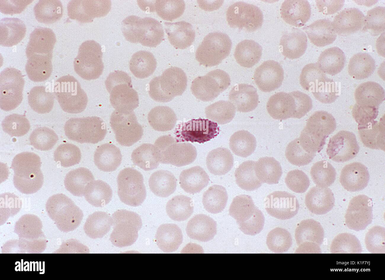 Diese photomicrograph zeigt eine Plasmodium ovale microgametocyte in einem ovalen roten Blutzellen (RBC), Mag. 1000 X. Die Gametocytes, männlich (microgametocytes) und weiblich (macrogametocytes), eine Anopheles-mücke Blut während einer Mahlzeit eingenommen werden. Die Parasiten? Vermehrung im moskito als sporogonic Zyklus bekannt. Bild mit freundlicher Genehmigung von CDC/Dr. Mae Melvin, 1974. Stockfoto