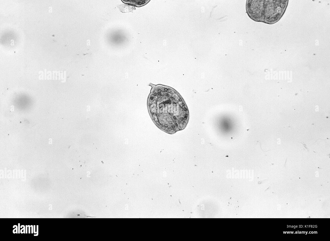 Unter einer niedrigen Vergrößerung von nur 100 X, das photomicrograph ergab drei Echinococcus sp. protoscolices, die von einem hydatid Zyste befreit worden war. Während ihres gesamten Lebenszyklus im Wirt, diese bandwürmer durch ein Ei, Bühne, gefolgt von einem oncosphere-Phase, die durch die Bildung einer zystischen Stadium gefolgt ist, in einem hydatid Zyste führt. Brechen dieser Zysten gibt diese Larven protoscolices und eine Bedingung, die als? hydatid Sand bekannt? (Siehe PHIL 1450). Hunde und andere caniden sind die endgültigen Wirte für Echinococcus spp. Menschen sind, werden nur von den Larven nach Verschlucken o infiziert Stockfoto
