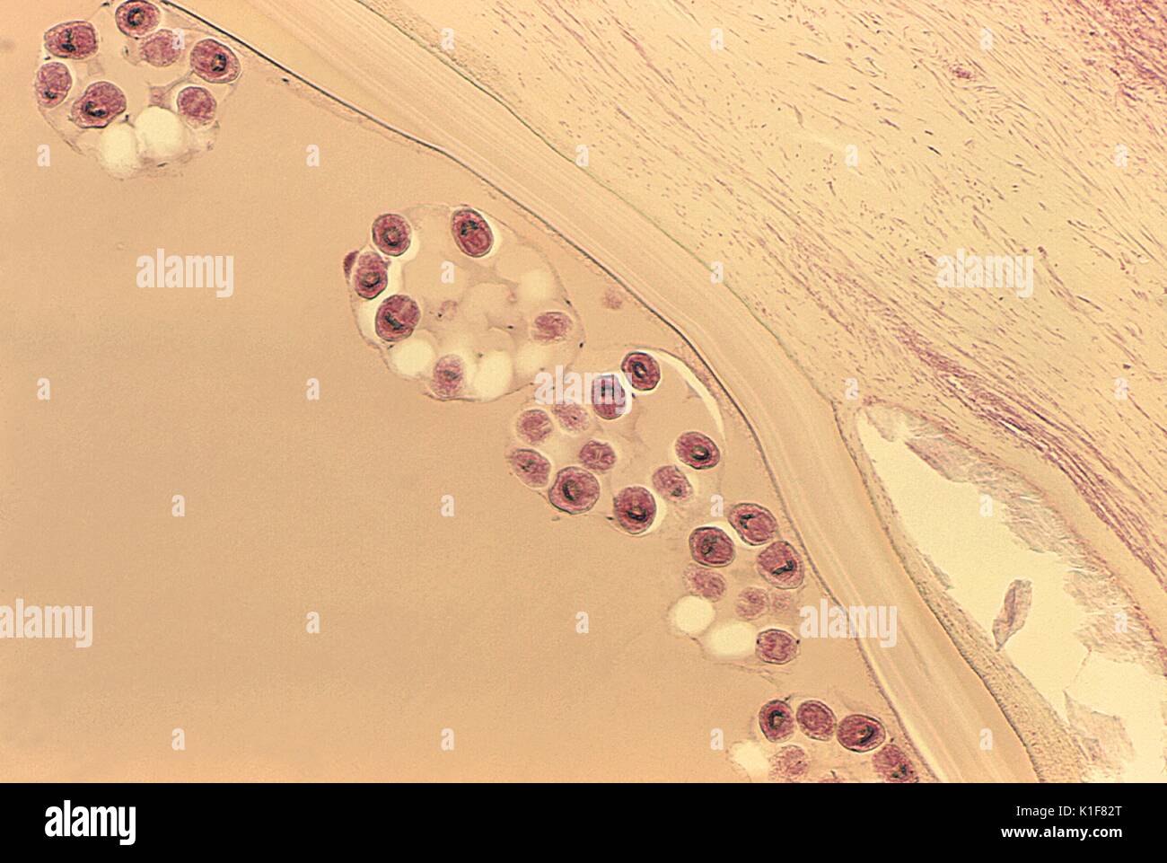 Unter einer niedrigen Vergrößerung von nur 40X, diese photomicrograph offenbart Nummern von gruppierten Echinococcus sp. protoscolices in diesem Bereich mit Schnitt eines hydatid Zyste. Während ihres gesamten Lebenszyklus im Wirt, diese bandwürmer durch ein Ei, Bühne, gefolgt von einem oncosphere-Phase, die durch die Bildung einer zystischen Stadium gefolgt ist, in Dieser hydatid Zyste führt. Bruch der diese Zysten löst die Larven protoscolices und eine Bedingung, die als? hydatid Sand bekannt? (Siehe PHIL 1450). Hunde und andere caniden sind die endgültigen Wirte für Echinococcus spp. Menschen sind, werden nur von den Larven befallen nach Inge Stockfoto