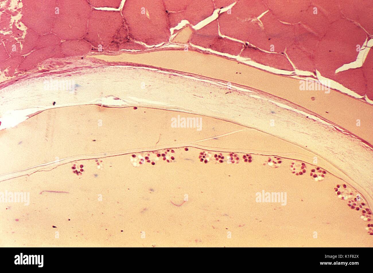 Unter einer niedrigen Vergrößerung von nur 10X, diese photomicrograph enthüllte der Ultrastrukturforschung Morphologie in einem abgetrennten Abschnitt einer Echinococcus sp gesehen. hydatid Zyste. Während ihres gesamten Lebenszyklus im Wirt, diese bandwürmer durch ein Ei, Bühne, gefolgt von einem oncosphere-Phase, die durch die Bildung einer zystischen Stadium gefolgt ist, in Dieser hydatid Zyste führt. Bruch der diese Zysten löst die Larven protoscolices und eine Bedingung, die als? hydatid Sand bekannt?. Hunde und andere caniden sind die endgültigen Wirte für Echinococcus spp. Menschen sind, werden nur von den Larven befallen nach Einnahme von Stockfoto