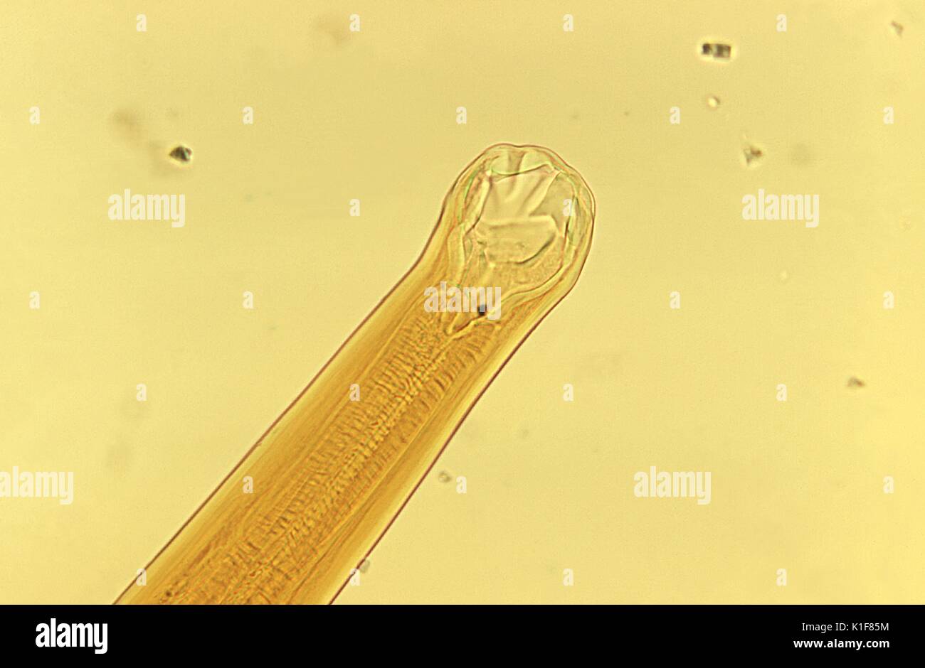 Ancylostoma braziliense Mund Teile. Ancylostoma braziliense Mund Teile. Hookworm, Parasiten. Bild mit freundlicher Genehmigung von CDC/Dr. Mae Melvin, 1973. Stockfoto