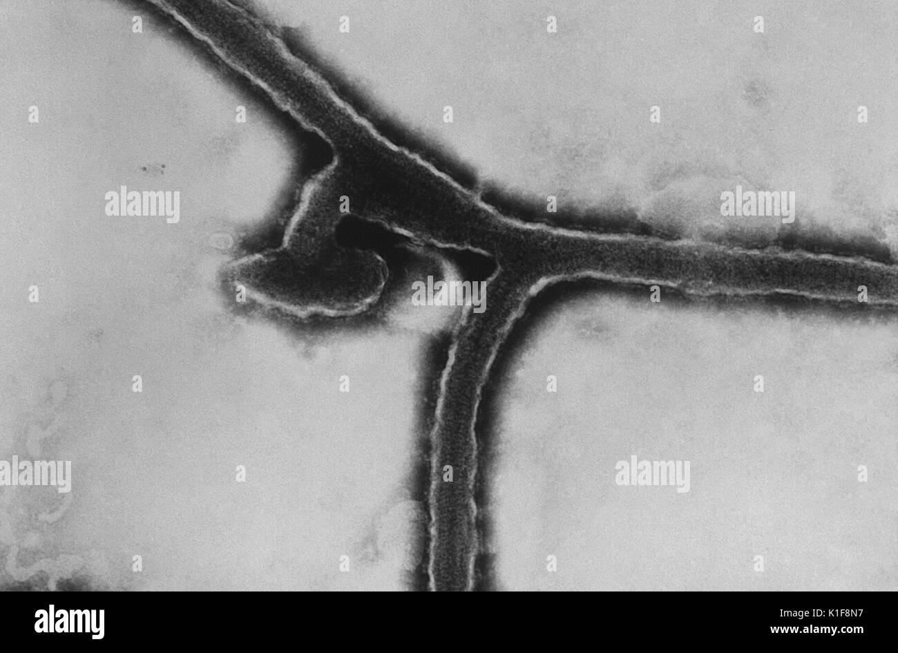 Diese Transmission Electron Micrograph (TEM) enthüllte der Ultrastrukturforschung Morphologie durch die Marburg Virus ausgestellt, die Ursache der Marburgfieber. Marburgfieber ist eine seltene, schwere Form des hämorrhagischen Fieber, das betrifft sowohl die Menschen und nicht-menschlichen Primaten. Verursacht durch eine genetisch einzigartig Zoonosen (Tier-borne) RNA-Virus der Familie filovirus, seine Anerkennung führte zur Schaffung dieses Virus Familie. Die fünf Arten von Ebola Virus sind die einzigen anderen bekannten Mitglieder der filovirus Familie. Bild mit freundlicher Genehmigung von CDC/Dr. Fredrick Murphy, Sylvia Whitfield, 1976. Stockfoto